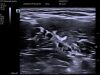 MINDRAY TE5 NEW Mindray TE5 Ultrasound System