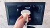 GE Versana Essential R1 2018 Ultrasound - OB / GYN
