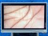 STRYKER 1588 Tower  Lcd Monitor  YOM: 2017 Laparoscope