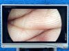 STRYKER 1588 Tower  Lcd Monitor  YOM: 2017 Laparoscope