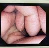OLYMPUS GIF-HQ290 Gastroscope