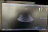 GE Vivid T9 Ultrasound - Cardiac - Vascular