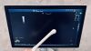 GE Logiq P9 XDclear 2016 Full list of options 4 probes included General ultrasound