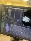 TOSHIBA Aquilion 64 CT Scanner