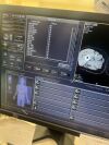 TOSHIBA Aquilion 64 CT Scanner