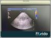 PHILIPS S4-1 CARDIAC SECTOR TRANSDUCER PROBE TESTED Ultrasound Transducer