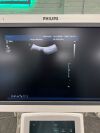 PHILIPS V6-2 Convex Ultrasound Transducer