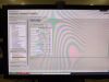 PHILIPS Achieva 1.5T dStream MRI Scanner