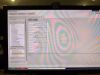 PHILIPS Achieva 1.5T dStream MRI Scanner