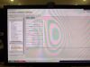 PHILIPS Achieva 1.5T dStream MRI Scanner