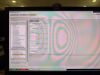 PHILIPS Achieva 1.5T dStream MRI Scanner