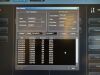 TOSHIBA Aquilion One Vision Edition CT Scanner