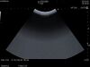 HITACHI C35 Ultrasound Transducer