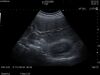 HITACHI C35 Ultrasound Transducer