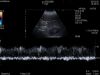 HITACHI C35 Ultrasound Transducer