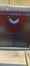 GE Voluson e8 Ultrasound - Shared Service