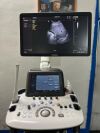 SAMSUNG-MEDISON H60 Samsung Medison Model H60 Ultrasound with Convex and Intracavitary Transducer