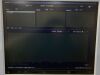 HITACHI HI VISION Avius Ultrasound - OB / GYN