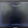 SAMSUNG HS40 Ultrasound - OB / GYN - Vascular