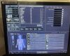 TOSHIBA 2009 Aquilion 64 Slice with 2023 tube CT Scanner