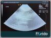 ACUSON 8V5 PHASED ARRAY TRANSDUCER PROBE TESTED Ultrasound Transducer