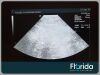 ACUSON 4V2 VECTOR ARRAY TRANSDUCER PROBE Ultrasound Transducer