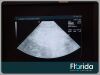 ACUSON 4V2 VECTOR ARRAY TRANSDUCER PROBE Ultrasound Transducer