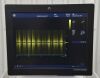 GE Vivid E9 XDclear Cardiac Ultrasound System W/ P2D Doppler Probe - 201534 Vivid E9 XDclear
