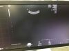 GE HEALTHCARE Voluson E8 BT18 Ultrasound