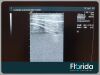 SIEMENS ACUSON 15L8W LINEAR ARRAY TRANSDUCER PROBE Ultrasound Transducer