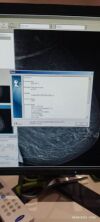 SECTRA L30 Digital Mammo Unit