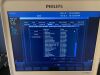 PHILIPS CX50 Ultrasound