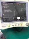 GE 2016792-002 Display Monitor