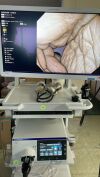 OLYMPUS GIF-1200N Gastroscope