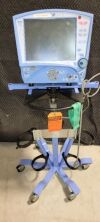CAREFUSION Vela Diamond Ventilator