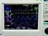 ZOLL R Series ALS W/ NIBP, CO2, ECG, SPO2, MFC, Pacing, & Paddles *FULLY LOADED* Defibrillator