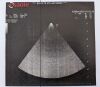 ESAOTE P2 3-11 Ultrasound Transducer