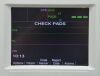ZOLL R Series ALS Defibrillator Monitor W/ OneStep Pacing Cable, Masimo, 3-Lead, &amp; Pacer - 201754 Defibrillator