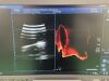 CANON Aplio i700 TUS-AI700 Ultrasound - OB / GYN