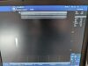 GE 9L-RS Ultrasound Transducer