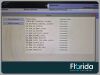 SIEMENS ACUSON SC2000 2016 ACUSON SC2000 ULTRASOUND SYSTEM MODEL 10433816 45 DAYS WARRANTY