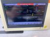 DRE MEDICAL EZ Waveline Monitor