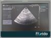 SIEMENS/ACUSON 2007 4V1C VECTOR ARRAY TRANSDUCER PROBE REF 07695724 TESTED 30 DAYS WARRANTY Ultrasound Transducer