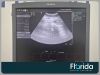 SIEMENS/ACUSON 6C2 CONVEX TRANSDUCER PROBE 30 DAYS WARRANTY Ultrasound Transducer