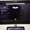 PHILIPS Affiniti 70G Ultrasound system