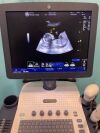 GENERAL ELECTRIC LOGIQ V5 Ultrasound machine, brand GENERAL ELECTRIC, model LOGIQ V5 Expert, VERSION R2.07