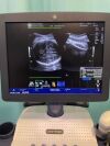 GENERAL ELECTRIC LOGIQ V5 Ultrasound machine, brand GENERAL ELECTRIC, model LOGIQ V5 Expert, VERSION R2.07