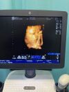 GENERAL ELECTRIC LOGIQ V5 Ultrasound machine, brand GENERAL ELECTRIC, model LOGIQ V5 Expert, VERSION R2.07