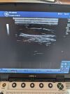 GE L8-18i-RS Ultrasound Transducer