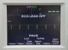 ZOLL R Series ALS Defibrillator Monitor W/ 3-Lead, Printer &amp; Pacer - 202000 Defibrillator
